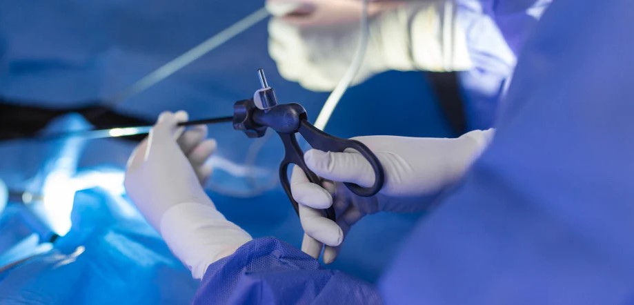Laparoscopia